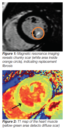 Figure 1 and 2 