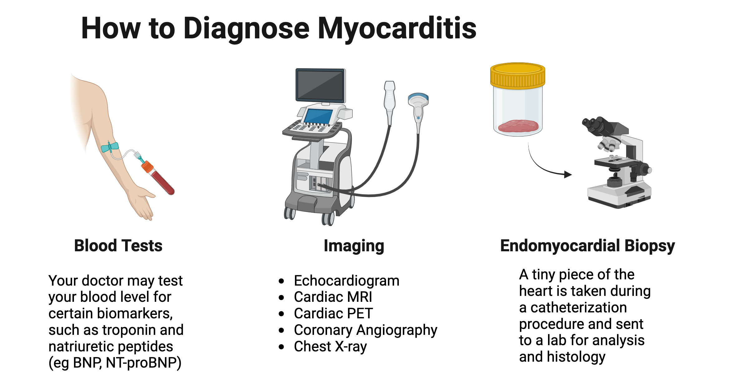 Diagnosis of myocarditis