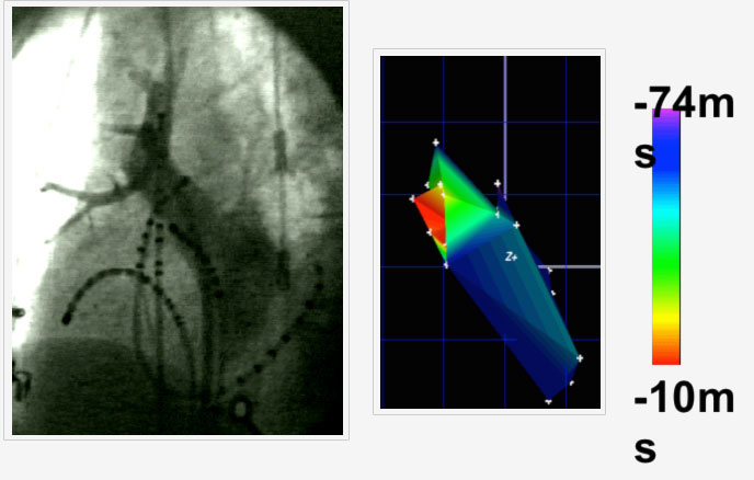 Image of pulmonary venogram