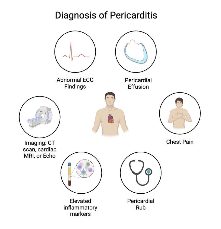 Diagnosis of Pericarditis 