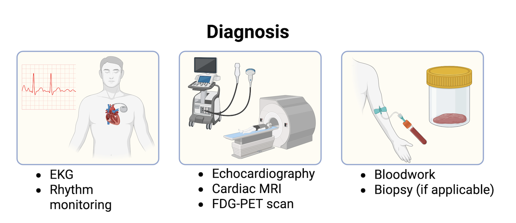 Diagnosis sarcoid 