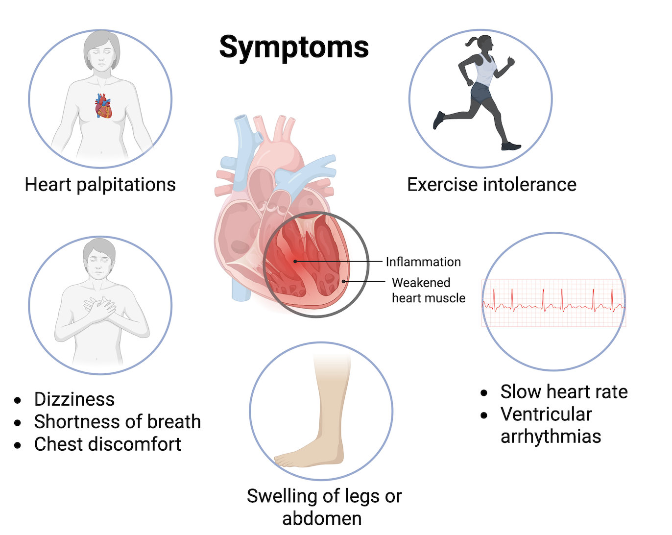 symptoms sarcoid 