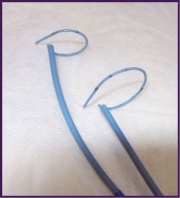 Circular mapping catheters PV isolation